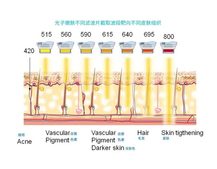 五大光子嫩膚技術(shù)（IPL、DPL、OPT、APT、BBL）及濾光片區(qū)別