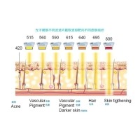 五大光子嫩膚技術(shù)（IPL、DPL、OPT、APT、BBL）及濾光片區(qū)別